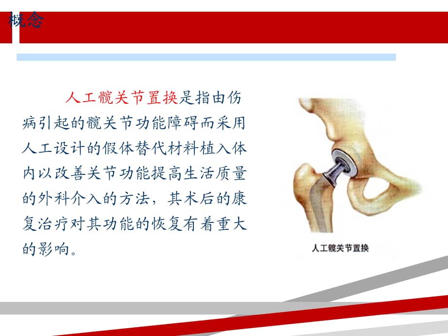 髋关节置换术后康复护理ppt课件pptx