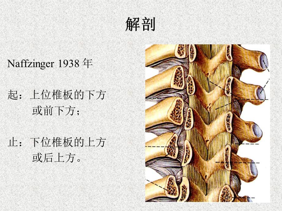 胸椎黄韧带骨化症诊疗课件pptx